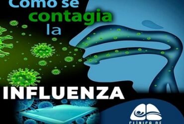 Influenza Influenza