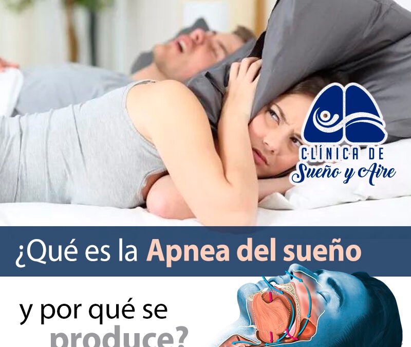 Casa Medica - La apnea del sueño es un trastorno común.