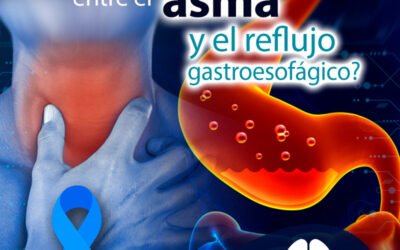 ¿Existe relación entre el asma y el reflujo gastroesofágico?