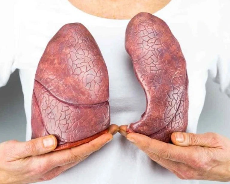 Fibrosis Pulmonar